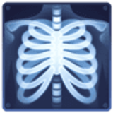 Zdjęcie rentgenowskie - Facebook