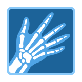 Zdjęcie rentgenowskie - Twitter / X